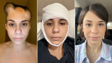  Sobreviviente al cáncer comparte su increíble recuperación  