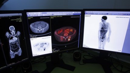 Desarrollan una biopsia líquida que detecta el cáncer colorrectal en fase inicial Desarrollan una biopsia líquida que detecta el cáncer colorrectal en fase inicial