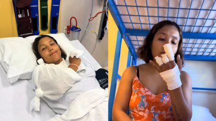   Chilena perdió dos dedos mientras trabajaba como instructora de buceo en Australia 