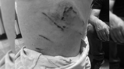   Denuncian ataques de jaurías de perros en Antofagasta 